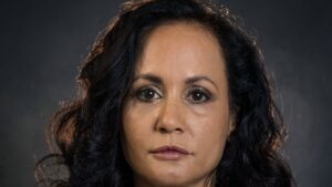 Gros plan sur le visage de Tess Christian montrant l'absence totale de rides d'expression autour des yeux et du front.